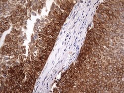 BFSP1 Mouse anti-Human, Clone: OTI1F4, lyophilized, TrueMAB 100 &mu;g;