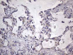 BFSP1 Monoclonal Antibody (OTI2B2), TrueMAB , OriGene 100 &mu;L; Unconjugated:Antibodies,