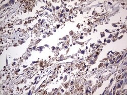 BFSP1 Mouse anti-Human, Clone: OTI2B2, lyophilized, TrueMAB 100 &mu;g;