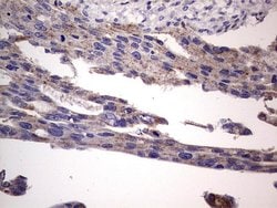 BFSP1 Mouse anti-Human, Clone: OTI2B2, lyophilized, TrueMAB 100 &mu;g;