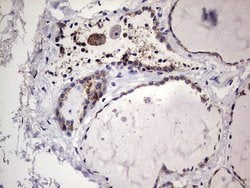 BFSP1 Mouse anti-Human, Clone: OTI2B2, lyophilized, TrueMAB 100 &mu;g;