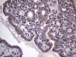 BFSP1 Mouse anti-Human, Clone: OTI2B2, lyophilized, TrueMAB 100 &mu;g;