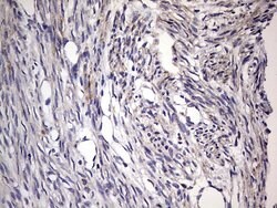 BFSP1 Monoclonal Antibody (OTI2B2), TrueMAB , OriGene 100 &mu;L; Unconjugated:Antibodies,