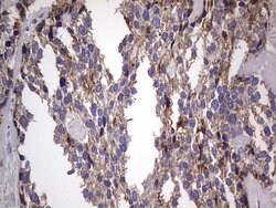 BFSP1 Monoclonal Antibody (OTI2B2), TrueMAB , OriGene 100 &mu;L; Unconjugated:Antibodies,