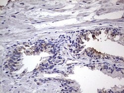 BFSP1 Monoclonal Antibody (OTI2B2), TrueMAB , OriGene 100 &mu;L; Unconjugated:Antibodies,