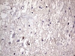 BFSP1 Mouse anti-Human, Clone: OTI2B2, lyophilized, TrueMAB 100 &mu;g;