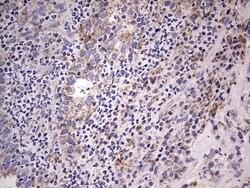 BFSP1 Mouse anti-Human, Clone: OTI2B2, lyophilized, TrueMAB 100 &mu;g;