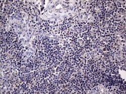 BFSP1 Mouse anti-Human, Clone: OTI2B2, lyophilized, TrueMAB 100 &mu;g;