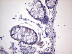 BFSP1 Mouse anti-Human, Clone: OTI2B2, lyophilized, TrueMAB 100 &mu;g;