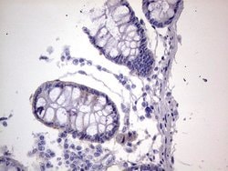 BFSP1 Monoclonal Antibody (OTI2B2), TrueMAB , OriGene 100 &mu;L; Unconjugated:Antibodies,