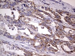 BFSP1 Monoclonal Antibody (OTI2B2), TrueMAB , OriGene 100 &mu;L; Unconjugated:Antibodies,