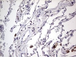 BFSP1 Monoclonal Antibody (OTI2B2), TrueMAB , OriGene 100 &mu;L; Unconjugated:Antibodies,