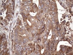 BFSP1 Mouse anti-Human, Clone: OTI3H6, lyophilized, TrueMAB 100 &mu;g;