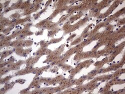 BFSP1 Mouse anti-Human, Clone: OTI3H6, lyophilized, TrueMAB 100 &mu;g;