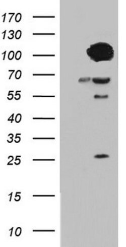 BFSP1 Mouse anti-Human, Clone: OTI2D2, lyophilized, TrueMAB 100 &mu;g;
