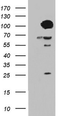 BFSP1 Monoclonal Antibody (OTI2D2), TrueMAB , OriGene 100 &mu;L; Unconjugated:Antibodies,