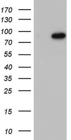 BFSP1 Monoclonal Antibody (OTI1F4), TrueMAB , OriGene 100 &mu;L; Unconjugated:Antibodies,