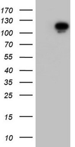 BFSP1 Mouse anti-Human, Clone: OTI2B2, lyophilized, TrueMAB 100 &mu;g;