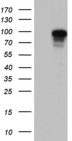 BFSP1 Mouse anti-Human, Clone: OTI3H6, lyophilized, TrueMAB 100 &mu;g;