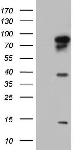 BFSP1 Monoclonal Antibody (OTI2C3), TrueMAB , OriGene 100 &mu;L; Unconjugated:Antibodies,