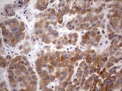 BFSP2 Mouse anti-Human, Clone: OTI1D9, lyophilized, TrueMAB 100 &mu;g;