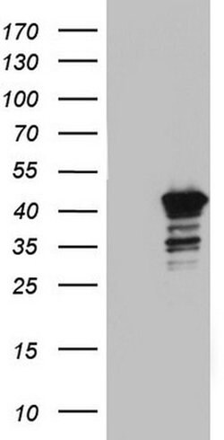 BFSP2 Monoclonal Antibody (OTI4D3), TrueMAB , OriGene 100 &mu;L; Unconjugated:Antibodies,