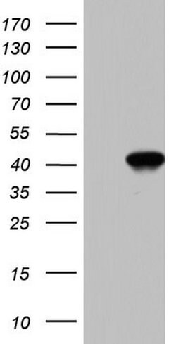 BFSP2 Mouse anti-Human, Clone: OTI1D9, lyophilized, TrueMAB 100 &mu;g;
