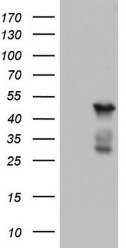 BFSP2 Mouse anti-Human, Clone: OTI2G2, lyophilized, TrueMAB 100 &mu;g;