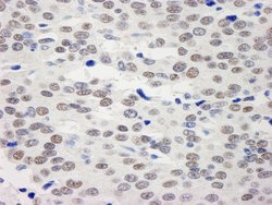 BHC110/LSD1 Polyclonal Antibody, Bethyl Laboratories 100 &mu;L; Unconjugated:Antibodies,