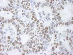 BHC110/LSD1 Polyclonal Antibody, Bethyl Laboratories:Antibodies:Primary