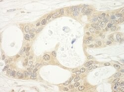 BHD Polyclonal Antibody, Bethyl Laboratories 10 &mu;L; Unconjugated:Antibodies,
