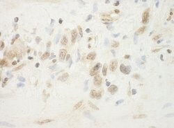 BHD Polyclonal Antibody, Bethyl Laboratories 10 &mu;L; Unconjugated:Antibodies,