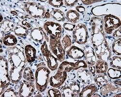 BHMT Monoclonal Antibody (OTI1E5), TrueMAB , OriGene 100 &mu;L; Unconjugated:Antibodies,