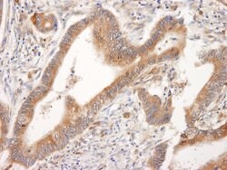 BID Rabbit anti-Human, Polyclonal, Bethyl Laboratories 100 &mu;L; Unconjugated:Antibodies,