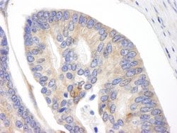 BID Polyclonal Antibody, Bethyl Laboratories 10 &mu;L | Buy Online | Bethyl Laboratories, Inc | Fisher Scientific