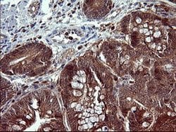 BID Monoclonal Antibody (OTI2A2), TrueMAB , OriGene 100 &mu;L; Unconjugated:Antibodies,