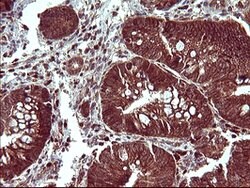 BID Mouse anti-Human, Clone: OTI3C8, lyophilized, TrueMAB 100 &mu;g; Unconjugated:Antibodies,