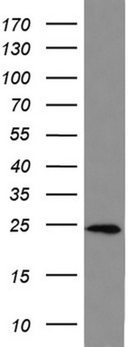 BID Mouse anti-Human, Clone: UMAB139, liquid, UltraMAB 30 &mu;L; Unconjugated:Antibodies,