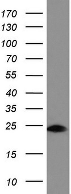 BID Mouse anti-Human, Clone: UMAB139, liquid, UltraMAB 30 &mu;L; Unconjugated:Antibodies,