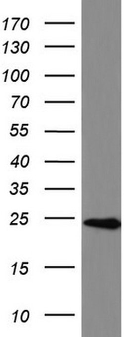 BID Mouse anti-Human, Clone: UMAB139, liquid, UltraMAB 30 &mu;L; Unconjugated:Antibodies,