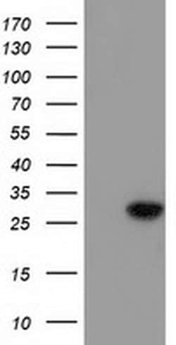 BIN3 Monoclonal Antibody (OTI2D7), TrueMAB , OriGene 100 &mu;L; Unconjugated:Antibodies,