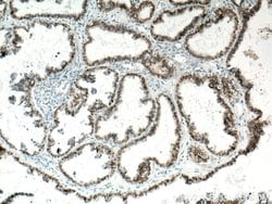 PAX8 Mouse anti-Human, Biotin, Clone: 4H7B3, Proteintech 100 &mu;L; Biotin:Antibodies,