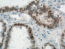 PAX8 Mouse anti-Human, Biotin, Clone: 4H7B3, Proteintech 100 &mu;L; Biotin:Antibodies,