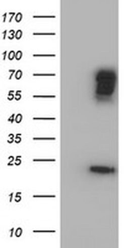 BIRC3 Monoclonal Antibody (OTI1E3), TrueMAB , OriGene 100 &mu;L; Unconjugated:Antibodies,