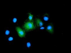 BIRC5/Survivin Monoclonal Antibody (OTI6H5), TrueMAB , OriGene 100 &mu;L;