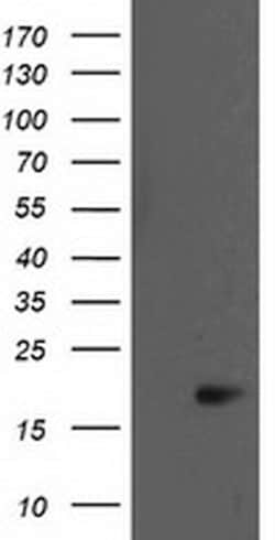 BIRC5/Survivin Monoclonal Antibody (OTI2D3), TrueMAB , OriGene 100 &mu;L;