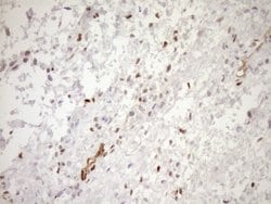 BLNK Mouse anti-Human, Clone: OTI4C9, TrueMAB , Origene 30 &mu;L; Unconjugated:Antibodies,