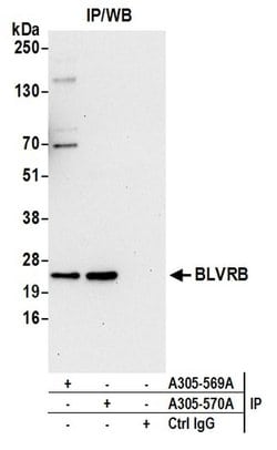 BLVRB/Biliverdin reductase B Rabbit anti-Human, Polyclonal, Bethyl Laboratories