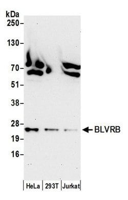 BLVRB/Biliverdin reductase B Polyclonal Antibody, Bethyl Laboratories 20