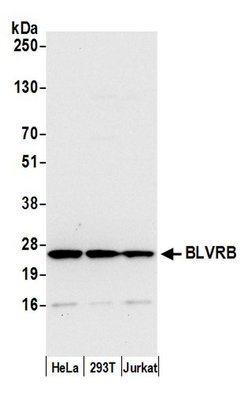 BLVRB/Biliverdin reductase B Polyclonal Antibody, Bethyl Laboratories 20